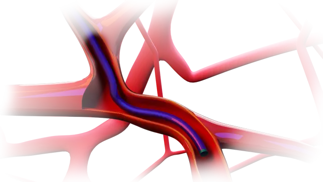 Stur Steerable Guiding Sheath Form preview image